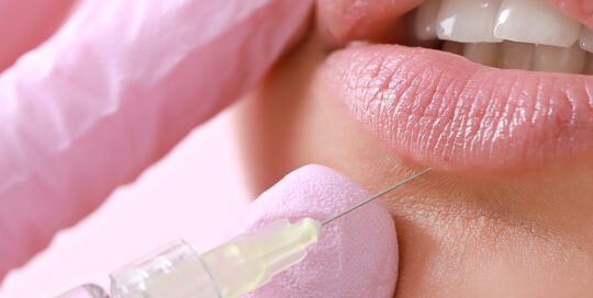 women getting fillers in her lips for more plump lips