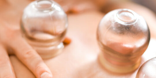 cupping massage therapy