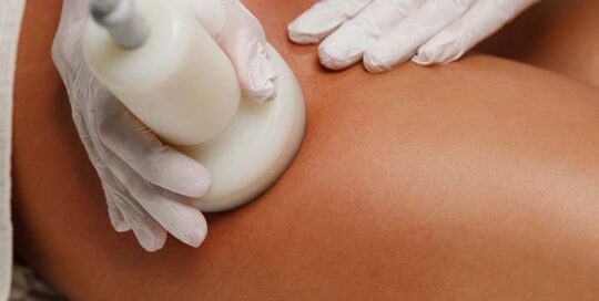 cellulite reduction treatment photo