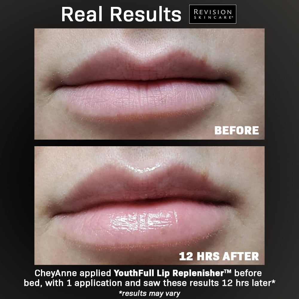 Youthfull Lip Replenisher - Image 2